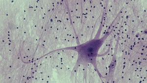 motor-neuron-brain-byte-thumbnail_3
